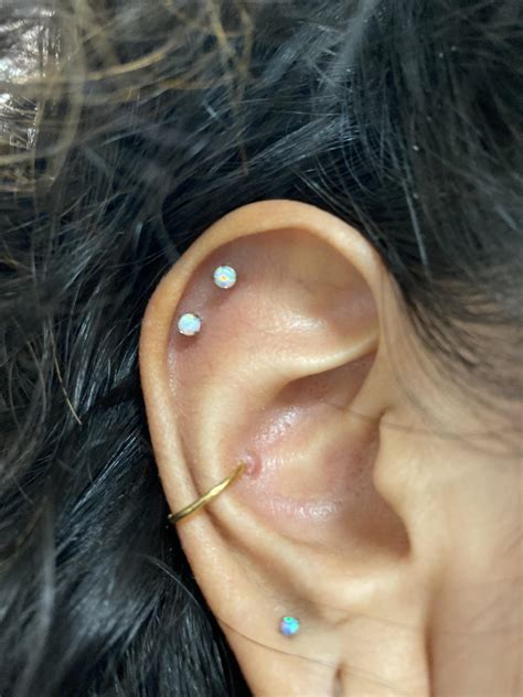 bump on conch piercing|conch piercing not healing.